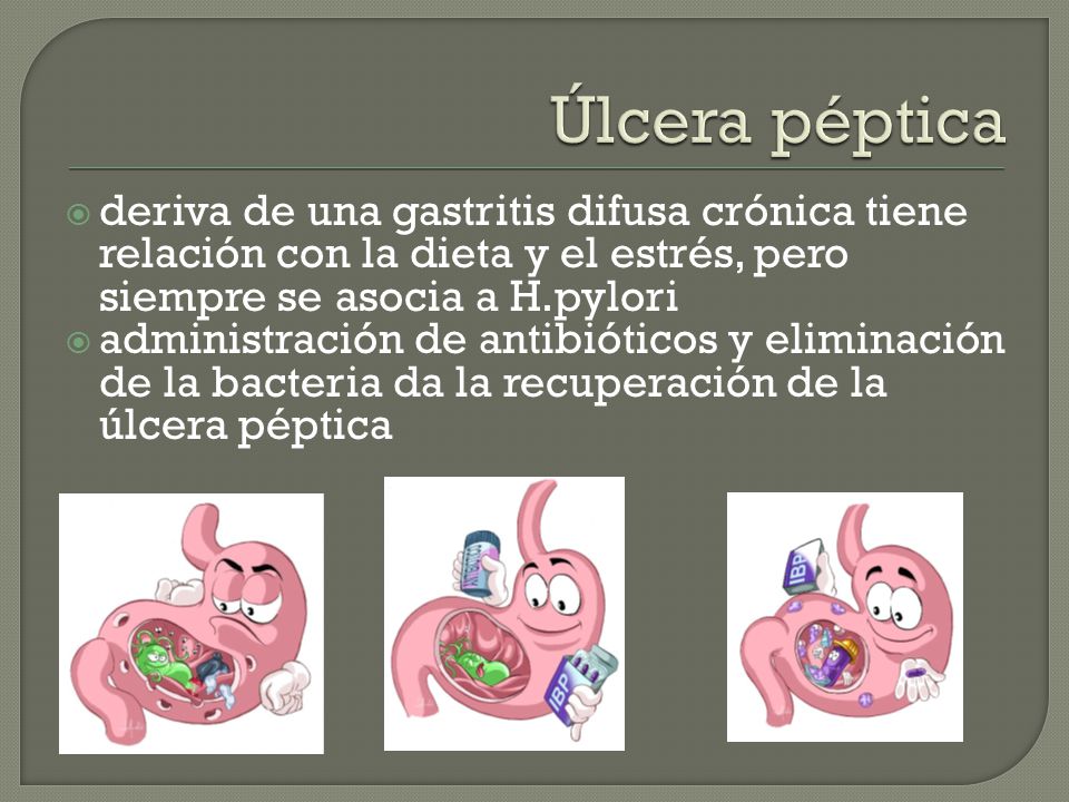 dieta para una ulcera peptica dieta para una ulcera peptica